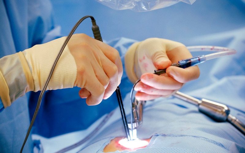 Laser Procedures in Bengaluru