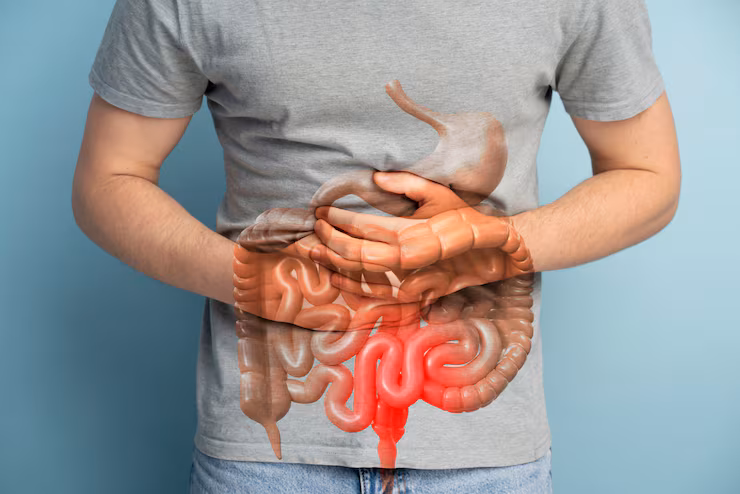 Rectal Cancer Treatment – Abdominoperineal Resection and Anterior Resection Surgery in Bengaluru