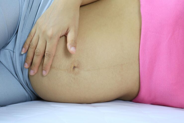 Laparoscopic Repair of Umbilical Hernia in Bengaluru